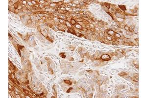 IHC-P Image Immunohistochemical analysis of paraffin-embedded SCC4 xenograft, using GAS2L1, antibody at 1:100 dilution. (GAS2L1 Antikörper)
