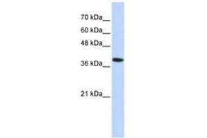 Image no. 1 for anti-ATPase, H+/K+ Exchanging, beta Polypeptide (ATP4b) (AA 215-264) antibody (ABIN6740866)