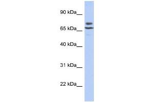 WB Suggested Anti-C3orf39 Antibody Titration:  0. (C3orf39 Antikörper  (N-Term))