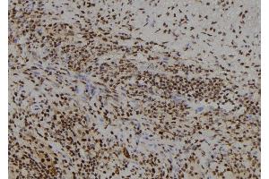 ABIN6278680 at 1/100 staining Human spleen tissue by IHC-P. (FSBP Antikörper  (Internal Region))