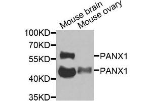 Western blot analysis of extracts of mouse brain and mouse ovary cells, using PANX1 antibody. (PANX1 Antikörper)