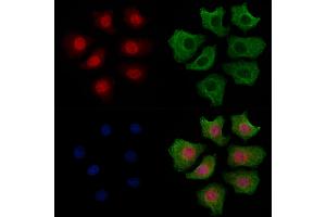 ABIN6256119 and ABIN6267471 staining HepG2 cells(4h of LPS treatment) by IF/ICC. (AKT1 Antikörper  (pSer124))