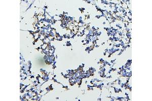 IHC analysis of CETP using anti-CETP antibody (ABIN7602439). (CETP Antikörper  (AA 77-353))