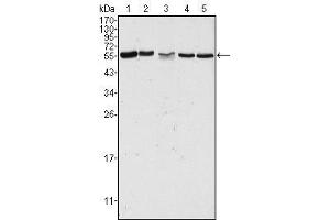 Western Blot showing PAK2 antibody used against Hela (1), Jurkat (2), A549 (3), HEK293 (4) and K562 (5) cell lysate.