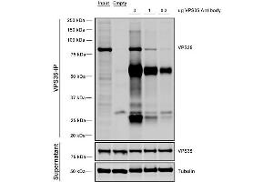 Immunoprecipitation analysis using Mouse Anti-VPS35 Monoclonal Antibody, Clone 11H10 (ABIN6933004). (VPS35 Antikörper)
