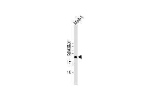 All lanes : Anti-ORMDL3 Antibody (Center) at 1:1000 dilution Lane 1: Molt-4 whole cell lysate Lysates/proteins at 20 μg per lane. (ORMDL3 Antikörper  (AA 53-81))