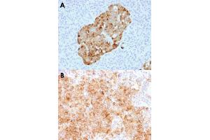 Immunohistochemical staining (Formalin-fixed paraffin-embedded sections) of human pancreas (A) and human parathyroid (B) with CHGA recombinant monoclonal antibody, clone CHGA/1731R . (Rekombinanter Chromogranin A Antikörper)