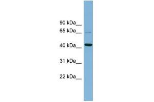 WB Suggested Anti-UEVLD Antibody Titration: 0. (UEVLD Antikörper  (Middle Region))