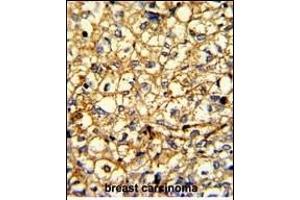 Immunohistochemistry (Paraffin-embedded Sections) (IHC (p)) image for anti-Adrenergic, alpha-2B-, Receptor (ADRA2B) (AA 343-369) antibody (ABIN652506)