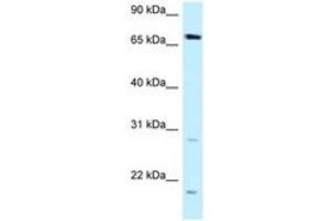 Image no. 1 for anti-Dystrophia Myotonica, WD Repeat Containing (DMWD) (AA 509-558) antibody (ABIN6747907) (DMWD Antikörper  (AA 509-558))