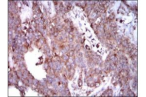Immunohistochemistry (IHC) image for anti-Signal Transducer and Activator of Transcription 5A (STAT5A) (AA 583-794) antibody (ABIN1845625) (STAT5A Antikörper  (AA 583-794))
