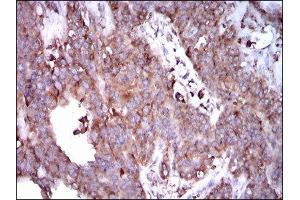 Immunohistochemistry (IHC) image for anti-Signal Transducer and Activator of Transcription 5A (STAT5A) (AA 583-794) antibody (ABIN1845625)