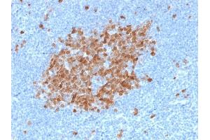 Immunohistochemistry (IHC) image for anti-Thymidylate Synthetase (TYMS) (AA 60-174) antibody (ABIN6940822)