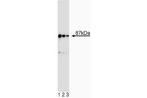 Western blot analysis of Ikkbeta.