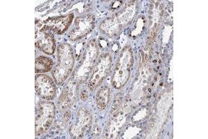 Immunohistochemical staining of human kidney with TMEM221 polyclonal antibody  shows strong cytoplasmic positivity in a subset of cells in renal tubules at 1:20-1:50 dilution. (TMEM221 Antikörper)