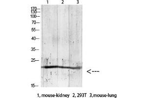 anti-Gremlin 2 (GREM2) (AA 71-120) antibody