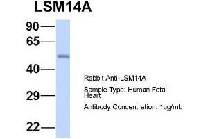 Host: Rabbit  Target Name: LSM14A  Sample Tissue: Human Fetal Heart  Antibody Dilution: 1.