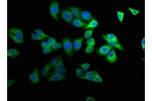 Immunofluorescence staining of HepG2 cells with ABIN7169172 at 1:100, counter-stained with DAPI. (Sbk2 Antikörper  (AA 62-330))