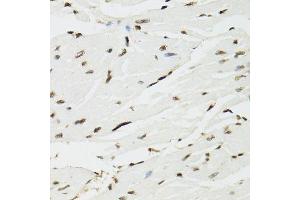 Immunohistochemistry (Paraffin-embedded Sections) (IHC (p)) image for anti-Endothelial Differentiation Related Factor 1 (EDF1) (AA 1-148) antibody (ABIN1679646)