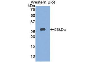 Western blot analysis of the recombinant protein. (Hexosaminidase A Antikörper  (AA 319-528))