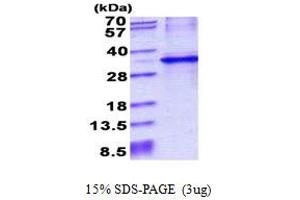 Cytochrome B5 Reductase 1 (CYB5R1) (AA 29-305) protein (His tag)