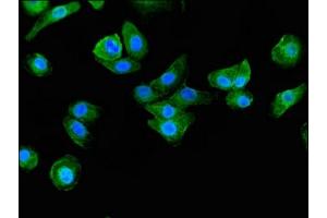 Immunofluorescence (IF) image for anti-BAI1-Associated Protein 2 (BAIAP2) (AA 123-368) antibody (ABIN7145729)