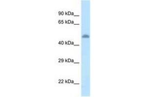 Image no. 1 for anti-tyrosine Aminotransferase (TAT) (AA 361-410) antibody (ABIN6747577) (TAT Antikörper  (AA 361-410))