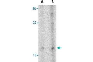 Western blot analysis of NRN1 in Daudi cell lysate with NRN1 polyclonal antibody  at (A) 5 and (B) 10 ug/mL . (NRN1 Antikörper  (Internal Region))