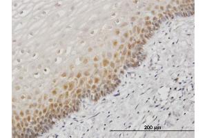 Immunoperoxidase of monoclonal antibody to HSPA1B on formalin-fixed paraffin-embedded human esophagus. (HSPA1B Antikörper  (AA 531-611))