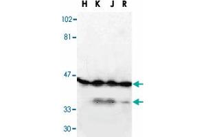 Western blot analysis of DFFA in HeLa, (H), K-562 (K), Jurkat (J), and Raji (R) whole cell lysate with DFFA polyclonal antibody  at 1 : 1000 dilution. (DFFA Antikörper  (AA 2-21))