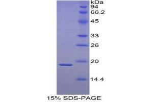 SDS-PAGE (SDS) image for Heat Shock 27kDa Protein 3 (HSPB3) (AA 1-150) protein (His tag) (ABIN1878071)
