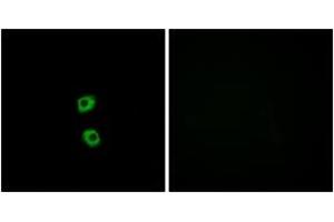 Immunofluorescence analysis of MCF7 cells, using FZD7 Antibody.