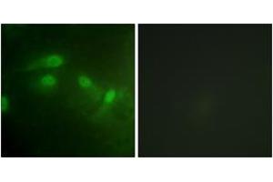 Immunofluorescence analysis of HeLa cells, using MDM2 (Phospho-Ser186+Ser188) Antibody. (MDM2 Antikörper  (pSer186))