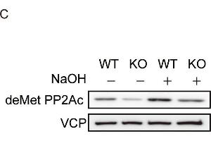 Western Blotting (WB) image for anti-Valosin Containing Protein (VCP) (N-Term) antibody (ABIN2856882)