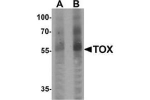 Western blot analysis of TOX in human colon tissue lysate with TOX Antibody  at (A) 1 and (B) 2 μg/ml. (TOX Antikörper  (N-Term))