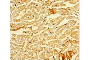 Immunohistochemistry of paraffin-embedded human heart tissue using ABIN7160220 at dilution of 1:100 (SMAD1 Antikörper  (AA 150-250))