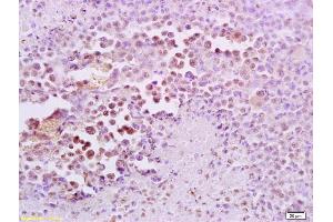 Formalin-fixed and paraffin embedded mouse lymphoma tissue labeled with Anti-FRA2/FOSL2 Polyclonal Antibody, Unconjugated (ABIN673104) at 1:200 followed by conjugation to the secondary antibody and DAB staining (FOSL2 Antikörper  (AA 231-326))
