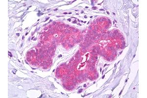 Anti-IST1 antibody IHC of human breast. (IST1 Antikörper)