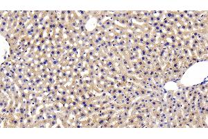 Detection of INSR in Mouse Liver Tissue using Polyclonal Antibody to Insulin Receptor (INSR) (Insulin Receptor Antikörper  (AA 1101-1372))