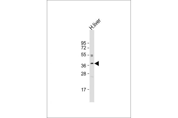 OR3A2 Antikörper  (C-Term)