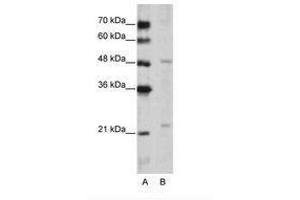 Image no. 1 for anti-WD Repeat Domain 12 (WDR12) (C-Term) antibody (ABIN202489) (WDR12 Antikörper  (C-Term))