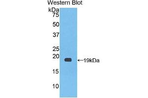 Western blot analysis of the recombinant protein. (Factor VIII Antikörper  (AA 1887-2044))