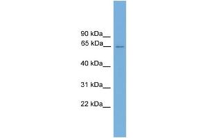 WB Suggested Anti-CARD9 Antibody Titration: 0. (CARD9 Antikörper  (Middle Region))