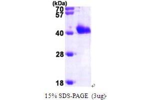 SDS-PAGE (SDS) image for GIPC PDZ Domain Containing Family, Member 1 (GIPC1) (AA 1-333) protein (His tag) (ABIN667795)