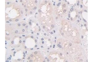 Immunohistochemistry (IHC) image for anti-Hermansky-Pudlak Syndrome 4 (HPS4) (AA 6-192) antibody (ABIN7443911)