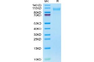 Cynomolgus CD31 on Tris-Bis PAGE under reduced condition. (CD31 Protein (AA 28-602) (His tag))