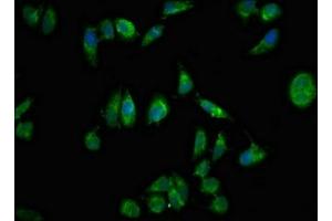 Immunofluorescent analysis of Hela cells using ABIN7161394 at dilution of 1:100 and Alexa Fluor 488-congugated AffiniPure Goat Anti-Rabbit IgG(H+L) (NPX1 Antikörper  (AA 88-227))