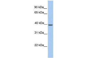WB Suggested Anti-Klkbl4 Antibody Titration: 0. (PRSS54 Antikörper  (C-Term))