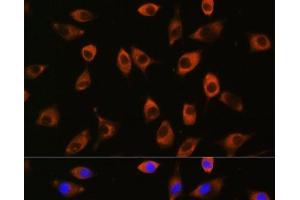 Immunofluorescence analysis of L929 cells using PPP1R9B Polyclonal Antibody at dilution of 1:100. (PPP1R9B Antikörper)