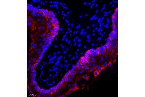Immunofluorescence of paraffin embedded rat esophagus using CK13 (ABIN7074412) at dilution of 1:1500 (400x lens) (Cytokeratin 13 Antikörper  (N-Term))